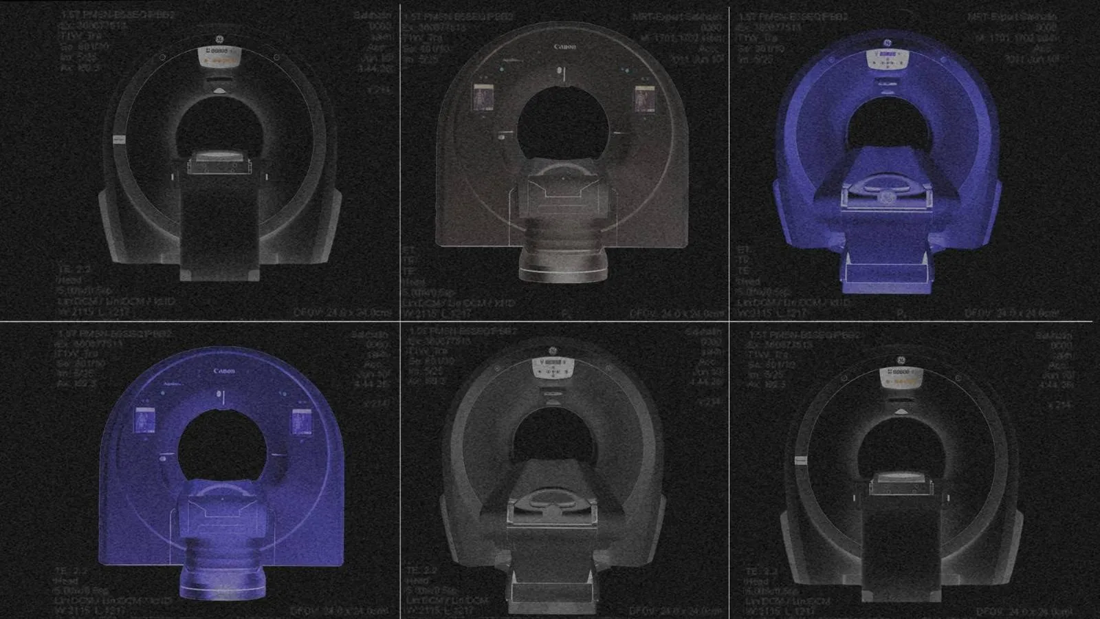 Рентген абсурду: як сотні мільйонів бюджетних гривень перетворилися на «мертві» томографи